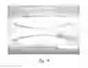 Fig. 63 - ABSORBENT ARTICLES HAVING SUBSTRATES HAVING ZONAL TREATMENTS
