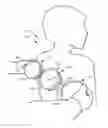 Fig. 01 - MASSAGE DEVICE AND METHOD