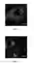 Fig. 04 - COMPOSITION WITH EXOGENOUS MITOCHONDRIA AS ACTIVE INGREDIENTS AND USE THEREOF AND CELL REPAIRING METHOD THEREFOR