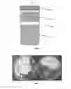 Fig. 02 - Compositions and methods for selective GI tract delivery