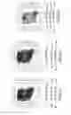 Fig. 09 - Compositions and methods for selective GI tract delivery