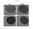 Fig. 16 - Kartogenin-conjugated chitosan particles with improved sustained release property and biocombatibility, and use thereof