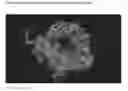 Fig. 03 - COMPOSITIONS AND METHODS FOR INCREASING NEUROTROPHIC PEPTIDES
