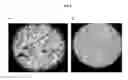 Fig. 05 - Novel Mensenchymal Stem Cells And Bone-Forming Cells
