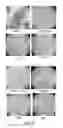 Fig. 07 - Novel Mensenchymal Stem Cells And Bone-Forming Cells