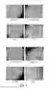 Fig. 08 - Novel Mensenchymal Stem Cells And Bone-Forming Cells