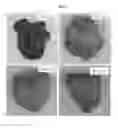 Fig. 02 - Composition for preventing or treating hyperlipidemia