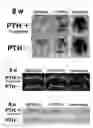 Fig. 02 - Method of bone regeneration or bone augmentation