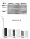 Fig. 03 - Method of bone regeneration or bone augmentation