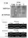 Fig. 04 - Method of bone regeneration or bone augmentation