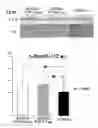 Fig. 05 - Method of bone regeneration or bone augmentation