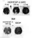 Fig. 06 - Method of bone regeneration or bone augmentation