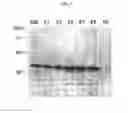 Fig. 04 - MULTIPLE VARIANTS OF MENINGOCOCCAL PROTEIN NMB1870