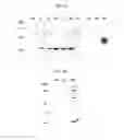 Fig. 05 - MULTIPLE VARIANTS OF MENINGOCOCCAL PROTEIN NMB1870