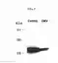 Fig. 06 - MULTIPLE VARIANTS OF MENINGOCOCCAL PROTEIN NMB1870