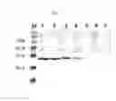 Fig. 08 - MULTIPLE VARIANTS OF MENINGOCOCCAL PROTEIN NMB1870