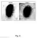 Fig. 06 - Attenuated Bordetella strains