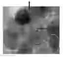 Fig. 01 - Materials and Methods for the Delivery of a Nanocarrier to the Brain