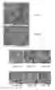 Fig. 07 - Materials and Methods for the Delivery of a Nanocarrier to the Brain