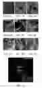 Fig. 08 - Materials and Methods for the Delivery of a Nanocarrier to the Brain