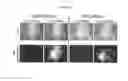 Fig. 09 - Use of charge-balanced imaging agents for determining renal function