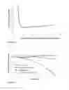 Fig. 06 - One component fibrin glue comprising zymogens