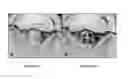 Fig. 02 - COMPOSITIONS AND METHODS FOR TREATING SPINAL CORD INJURY