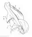 Fig. 09 - Heart assist device with expandable impeller pump