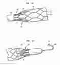 Fig. 16 - Heart assist device with expandable impeller pump
