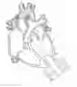 Fig. 01 - Implantable pump system having a coaxial ventricular cannula