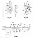 Fig. 05 - Medicament preparation and treatment devices, methods, and systems