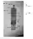 Fig. 01 - Ampule autoinjector systems and methods