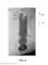 Fig. 05 - Ampule autoinjector systems and methods