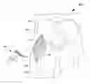 Fig. 01 - Methods for inhibiting heterotopic ossification