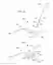 Fig. 25 - Methods for inhibiting heterotopic ossification