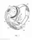 Fig. 02 - Package for an implantable neural stimulation device