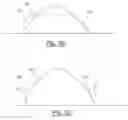 Fig. 04 - Arrhythmia electrotherapy device and method with provisions for mitigating patient discomfort