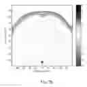 Fig. 09 - Ultrasound deep brain stimulation method and system
