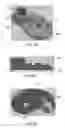 Fig. 09 - Disk-pack turbine