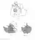 Fig. 04 - Cutter head for cutting materials, and cutter therefor