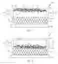 Fig. 03 - Conductive pre-impregnated composite sheet and method for making the same