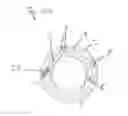 Fig. 09 - Plasticizing unit including a thermal separating device and an active tempering device
