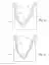 Fig. 07 - Method for eliminating radius wrinkles in composite laminates