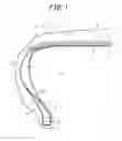 Fig. 02 - RUN-FLAT TIRE