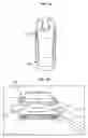 Fig. 02 - Analytic design of pedal override for adjustable speed limiting