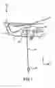 Fig. 02 - Systems and methods for positioning a hoist and hook