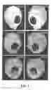 Fig. 02 - Osteogenic biomaterial