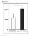 Fig. 07 - Car expression vector and car-expressing T cells