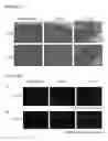 Fig. 13 - Car expression vector and car-expressing T cells