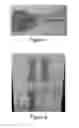 Fig. 02 - Colorimetric indicators for photocurable sealants